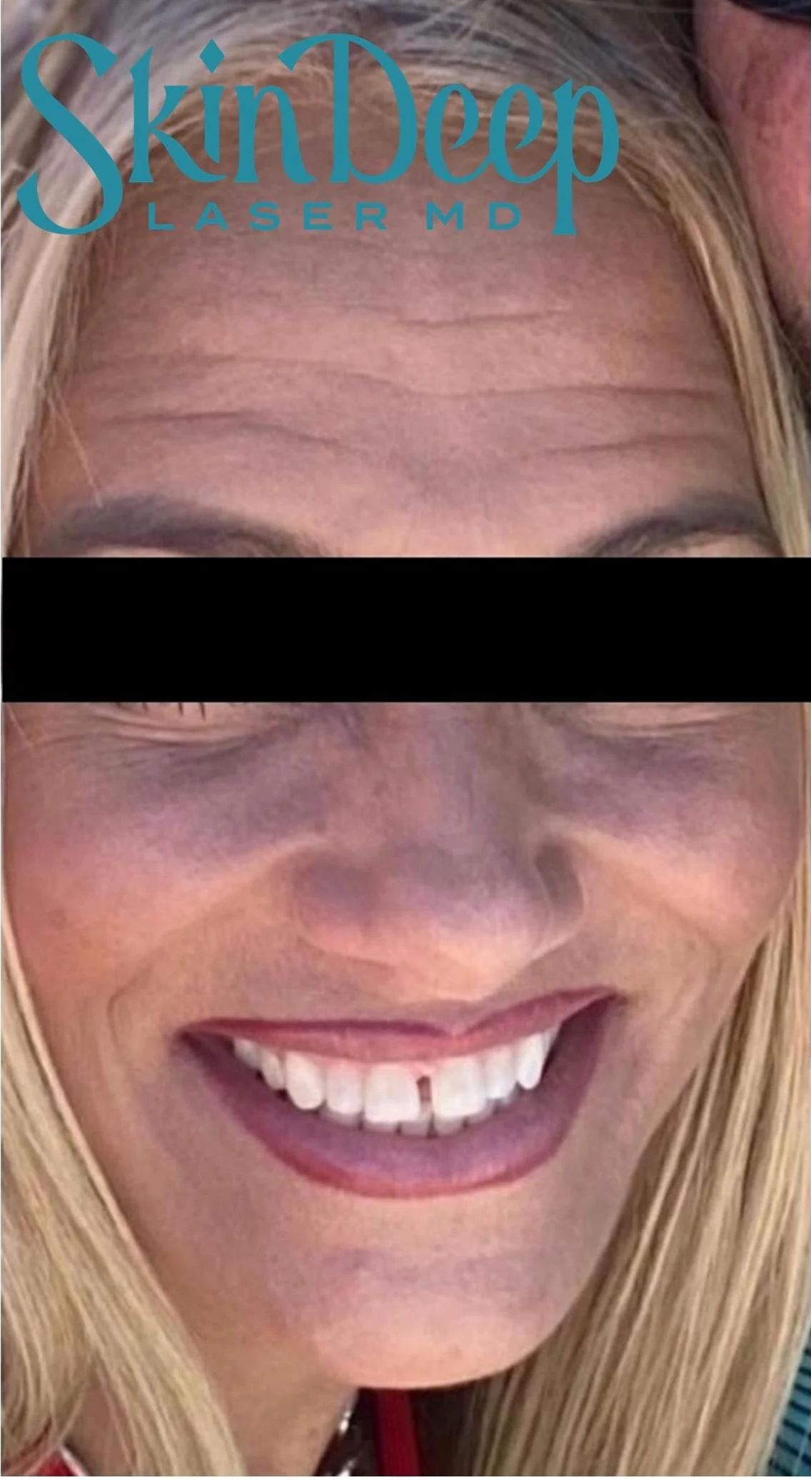 Pt 019 Rejuv Before.jpg