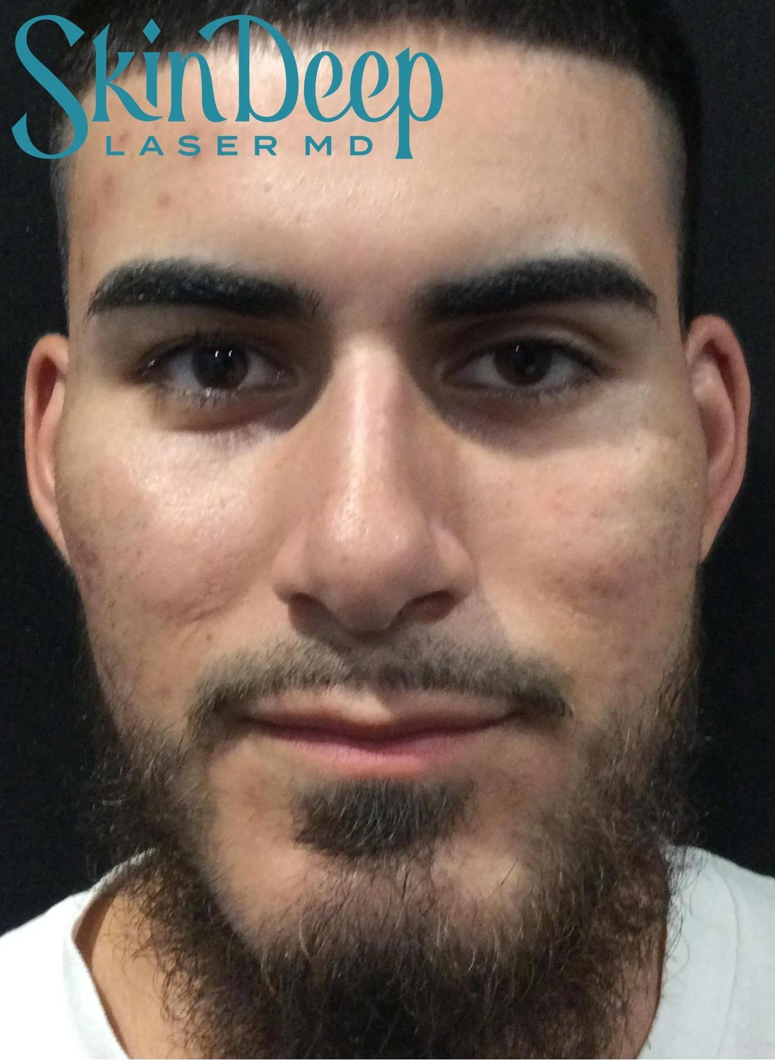 Pt 021 Peel Club Before.jpg