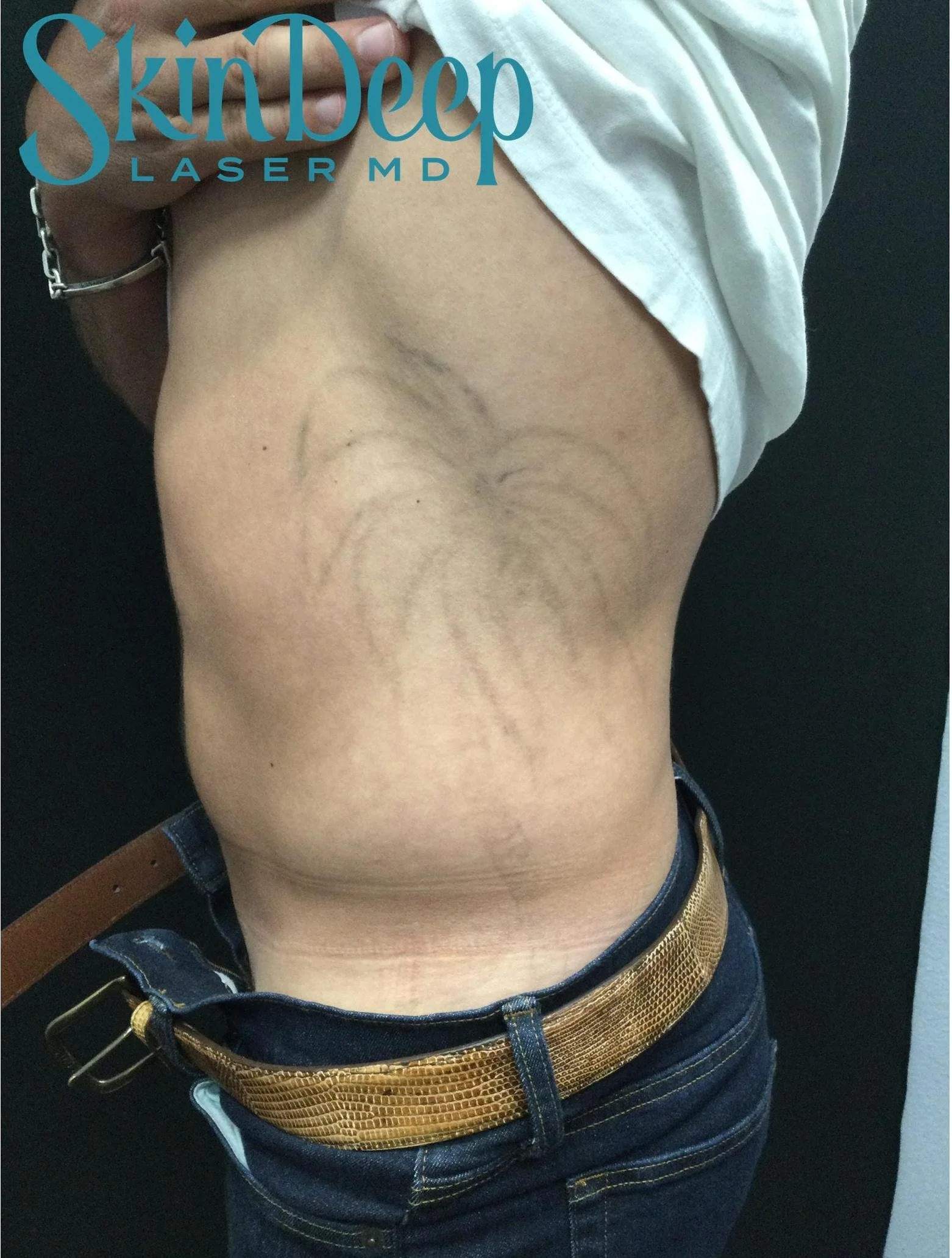 Pt 024 Tattoo Post 2 Tx.jpg