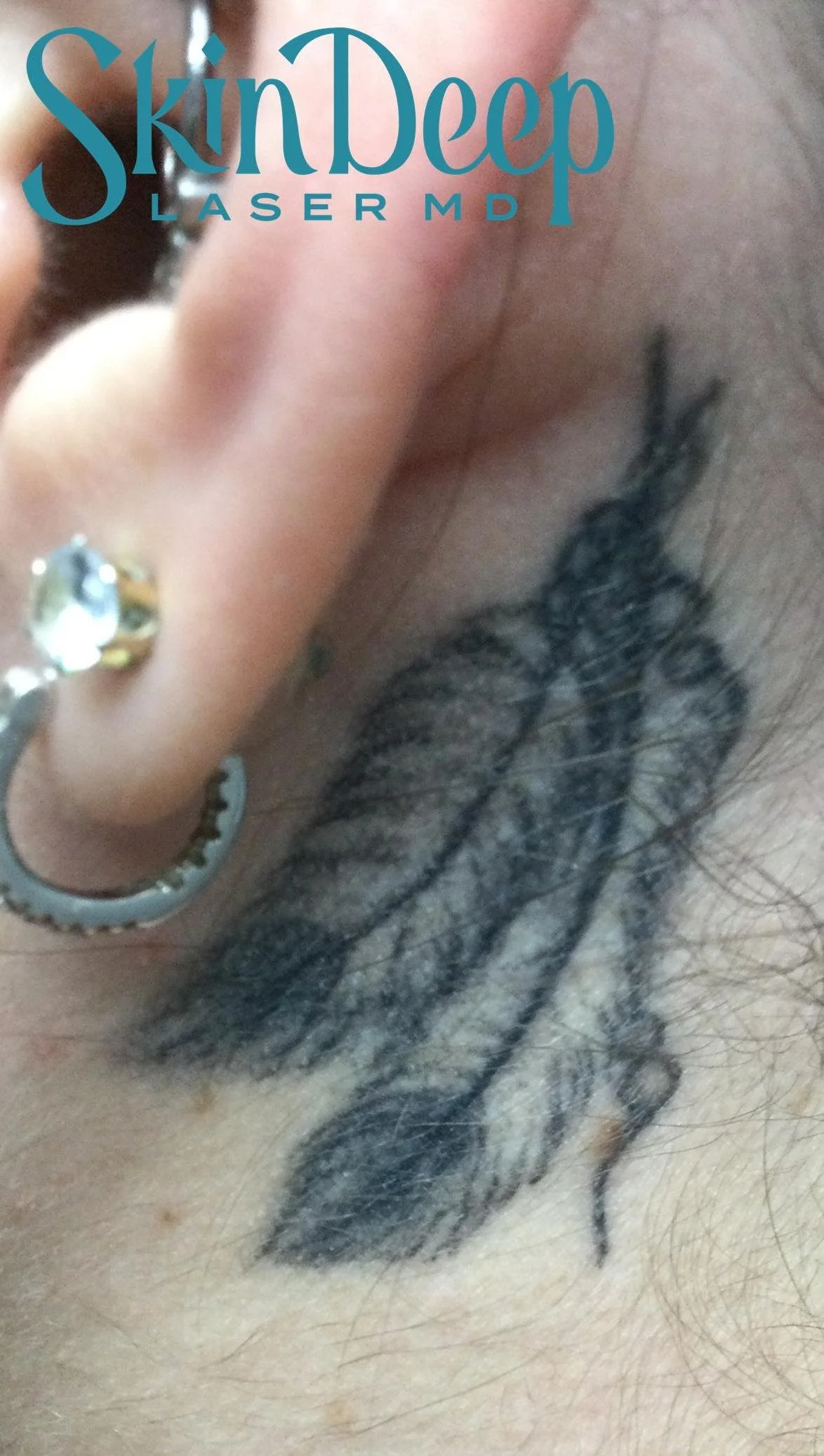PT 032 Tattoo Before.jpg
