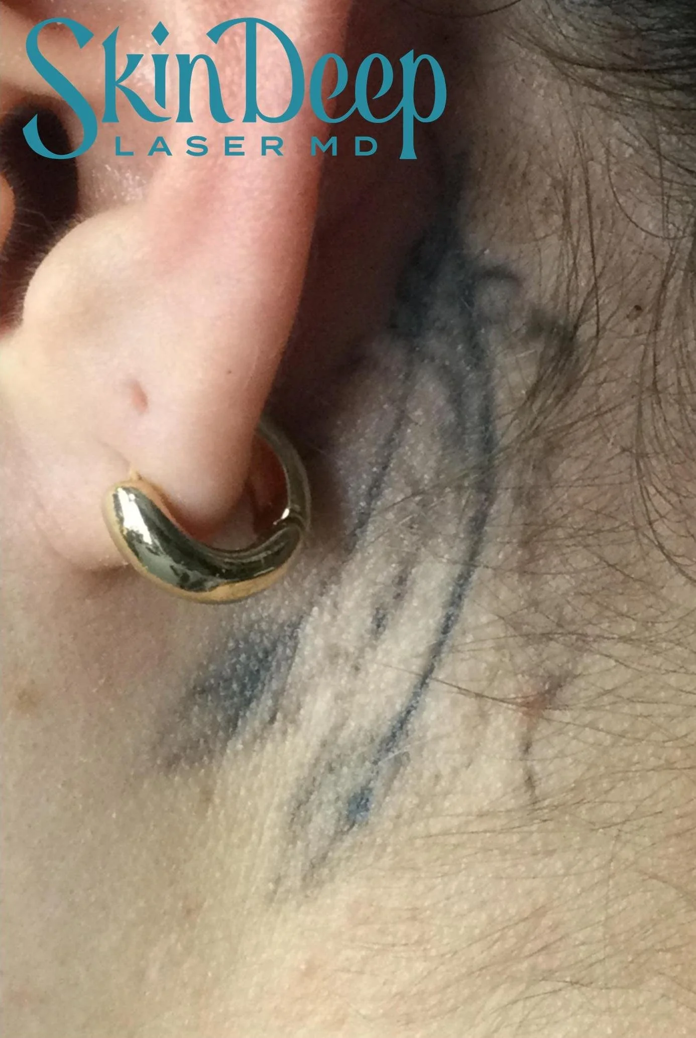 PT 032 Tattoo Post 8 Tx.jpg