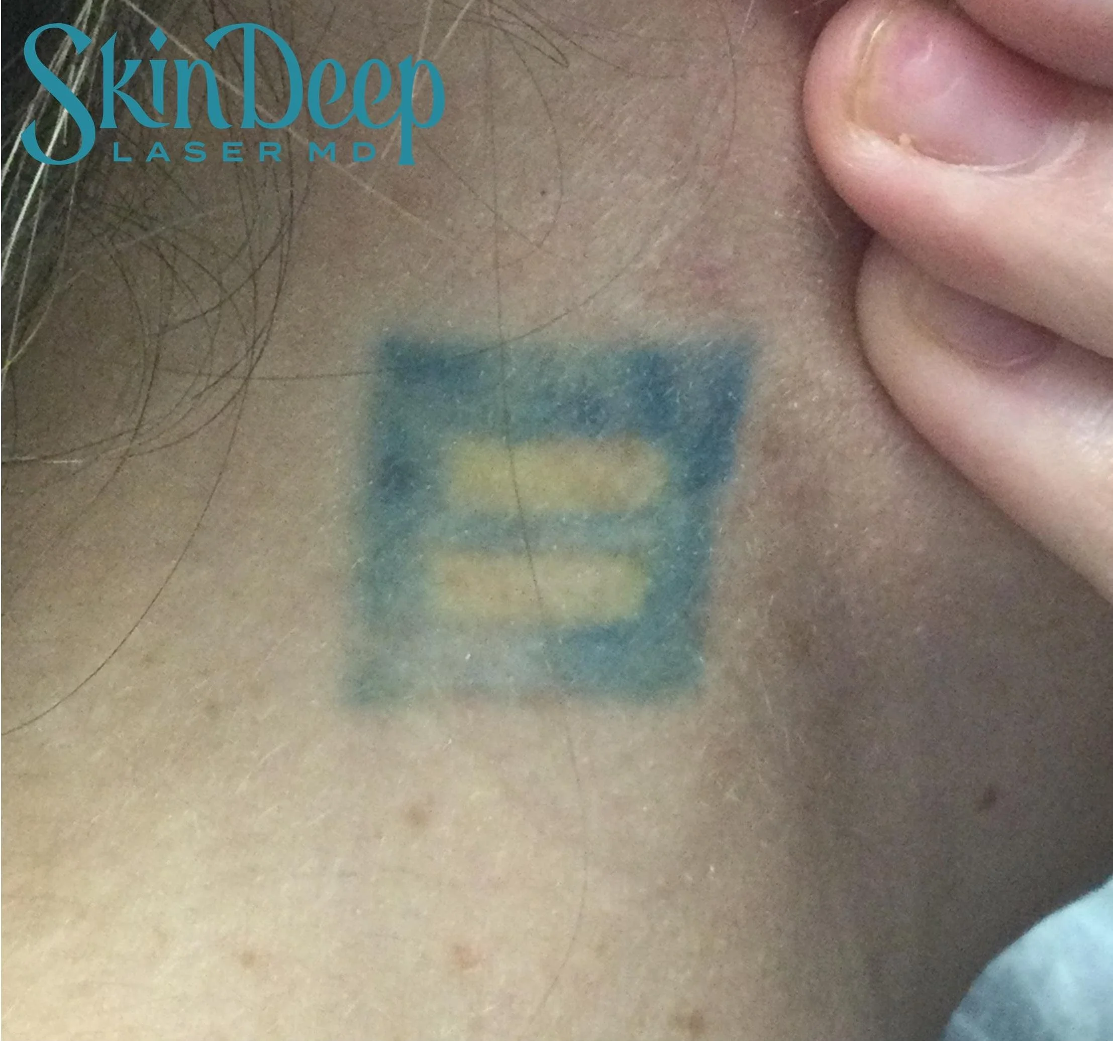 PT 041 Tattoo Post 3 Tx.jpg
