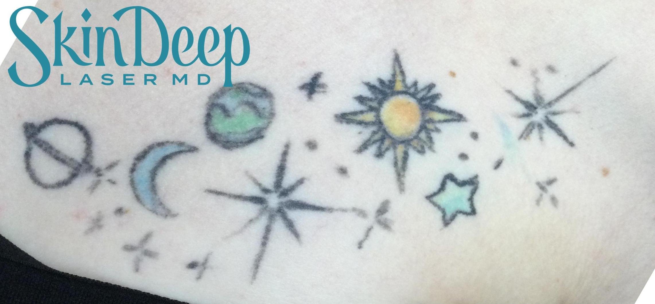 PT 042 Tattoo Before.jpg