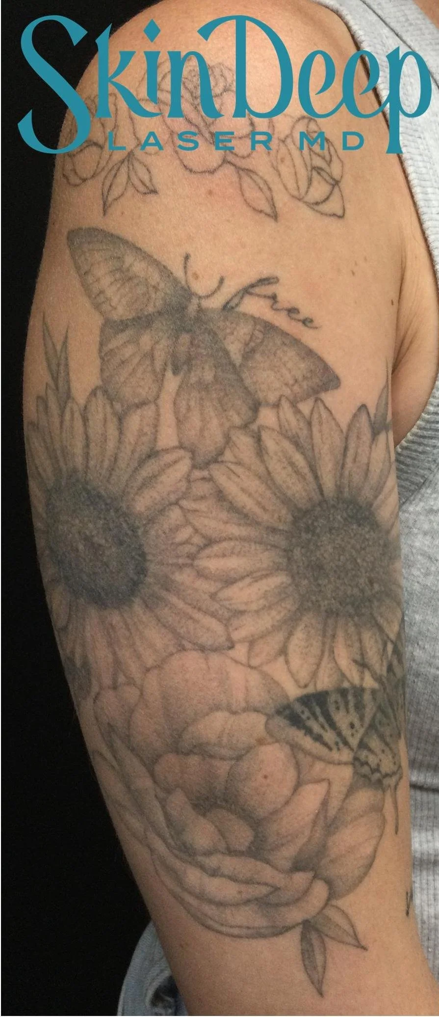 PT 044 Tattoo Before.jpg
