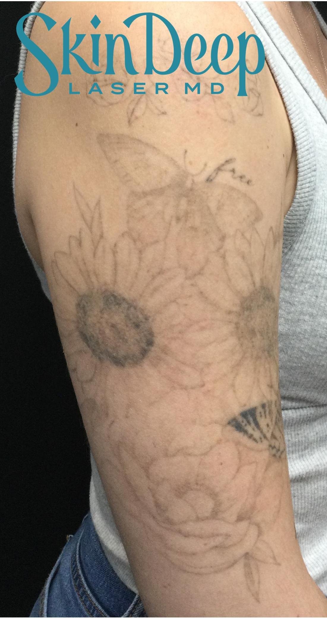 PT 044 Tattoo Post 3 Tx.jpg