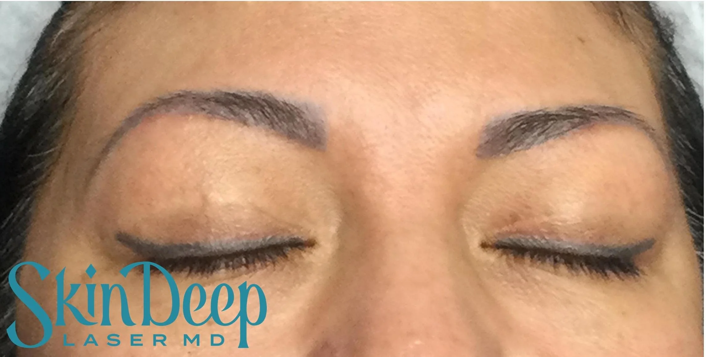 PT 046 Tattoo Eyebrows Before.jpg