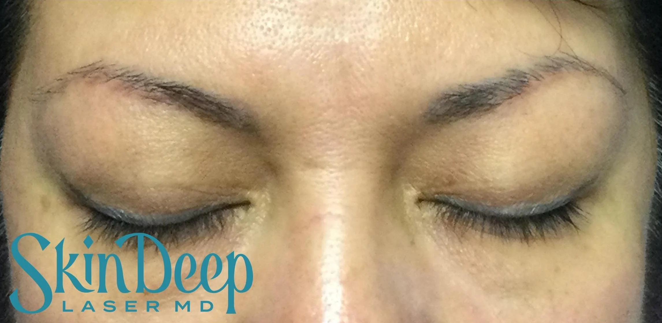PT 046 Tattoo Eyebrows Post 1 Tx.jpg