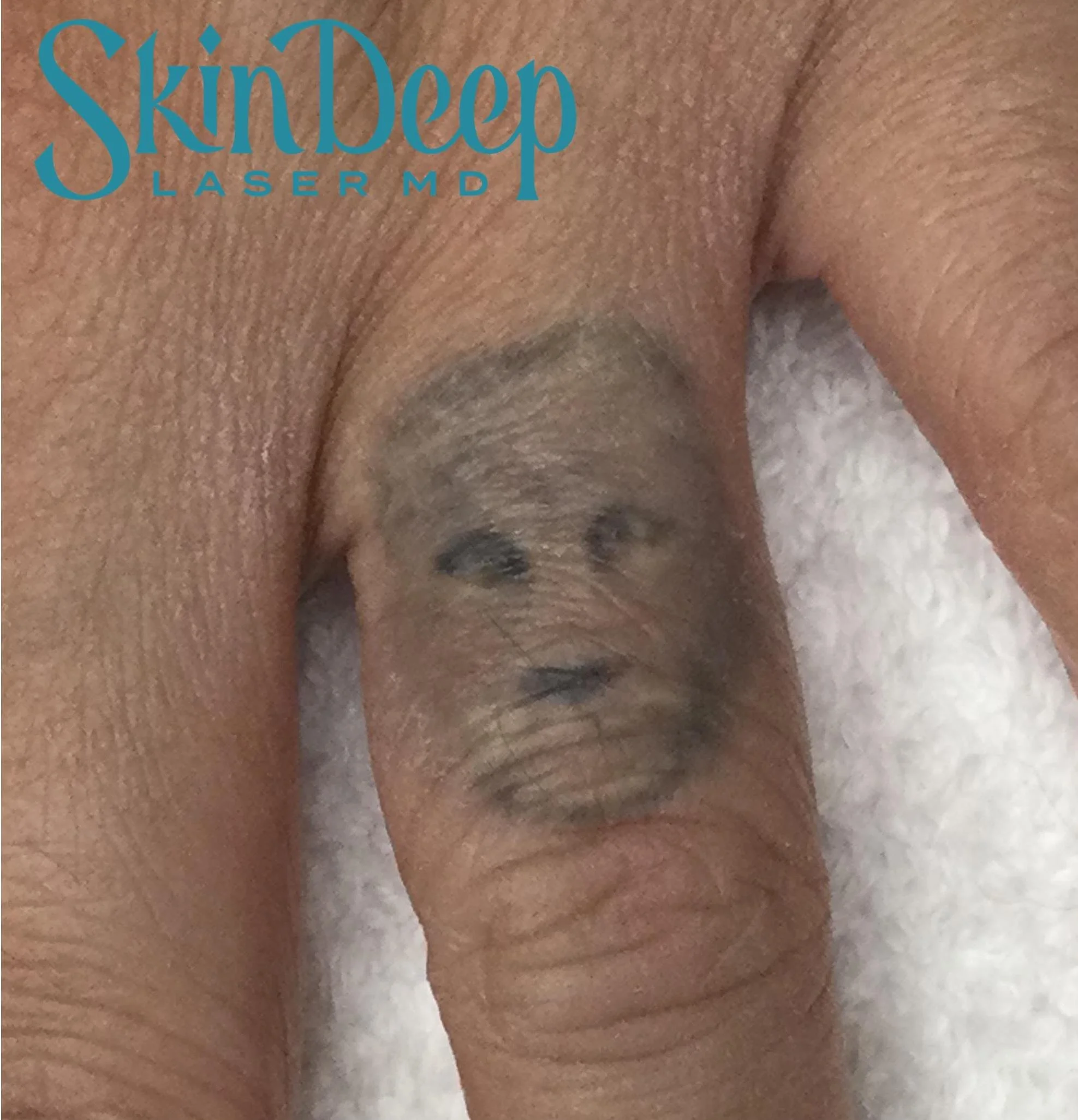 PT 052 Tattoo Before.jpg