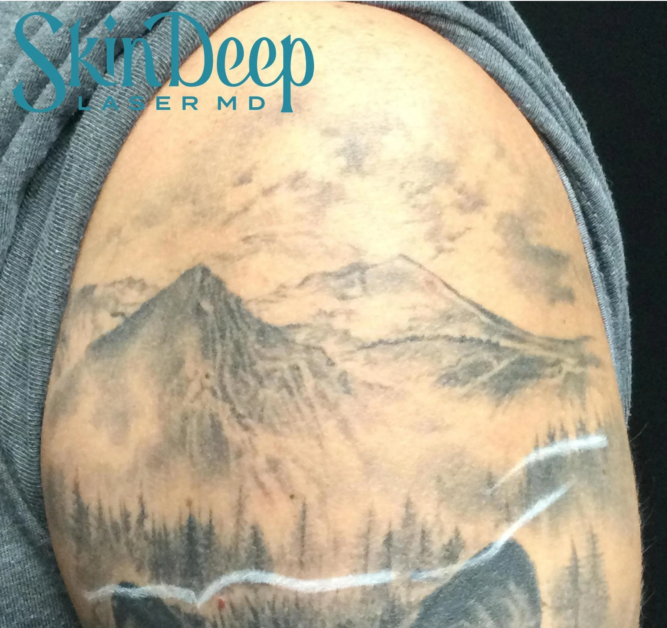 PT 055 Tattoo Before.jpg