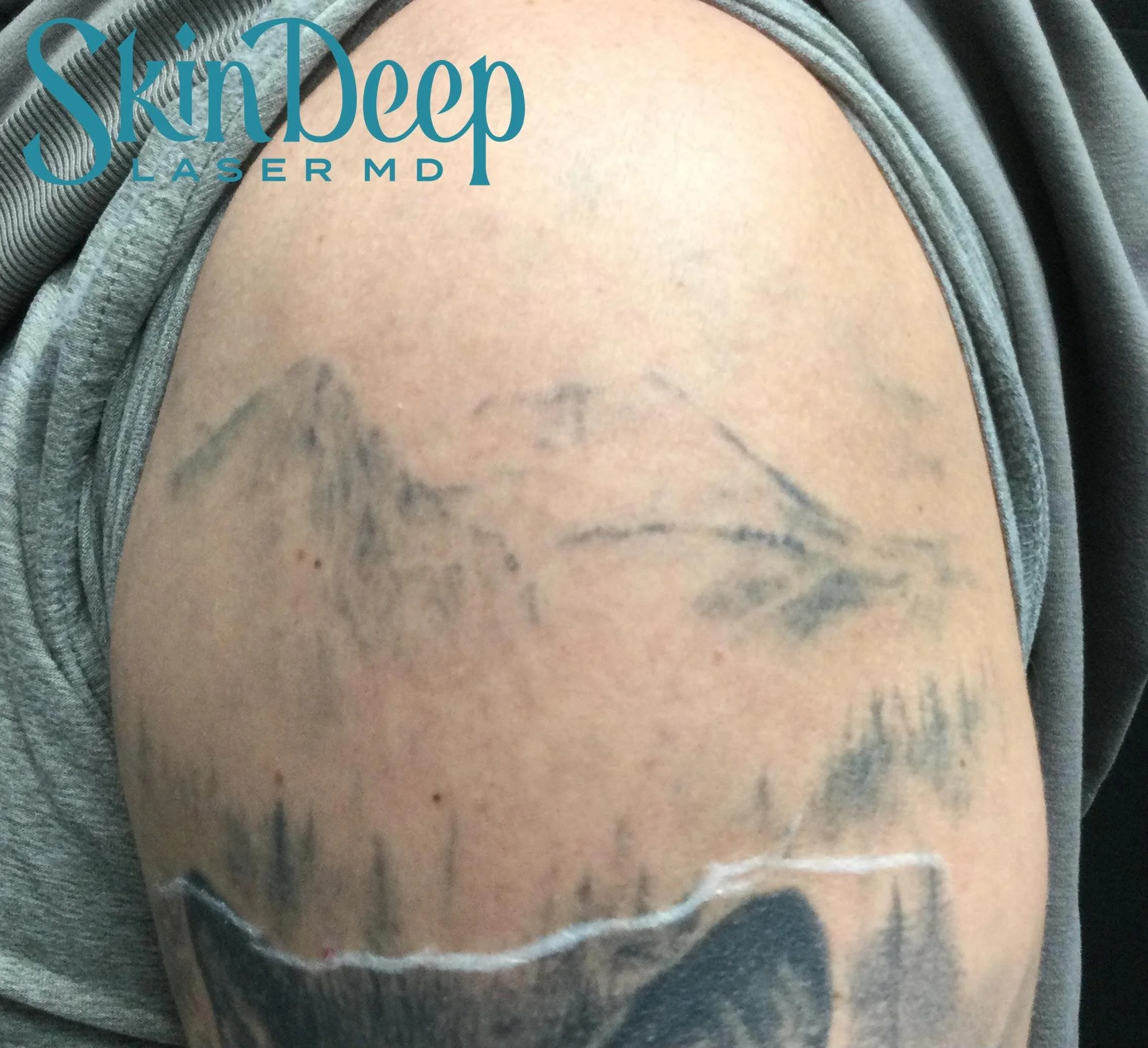 PT 055 Tattoo Post 3Tx.jpg