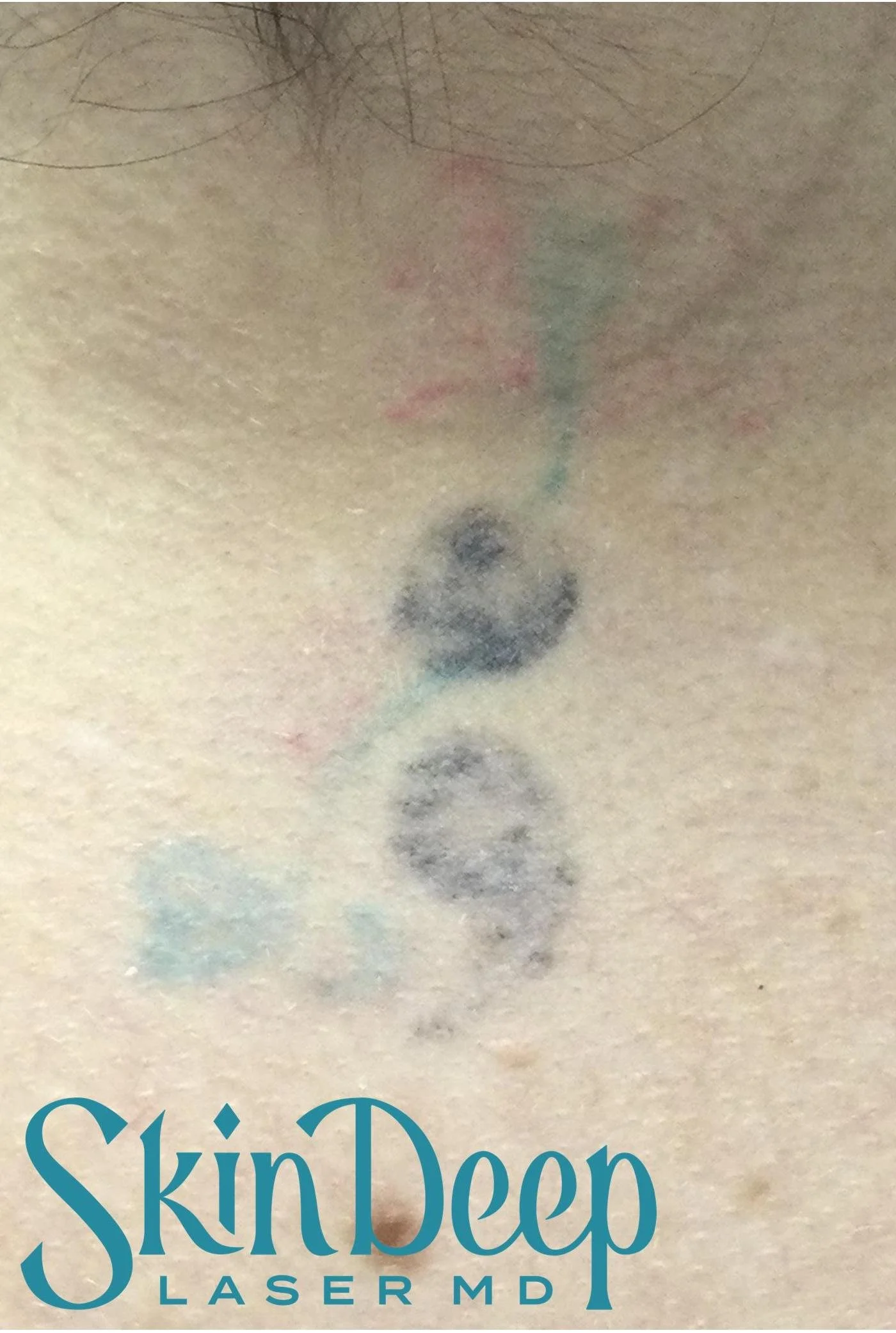 PT 058 Tattoo Post 3Tx.jpg