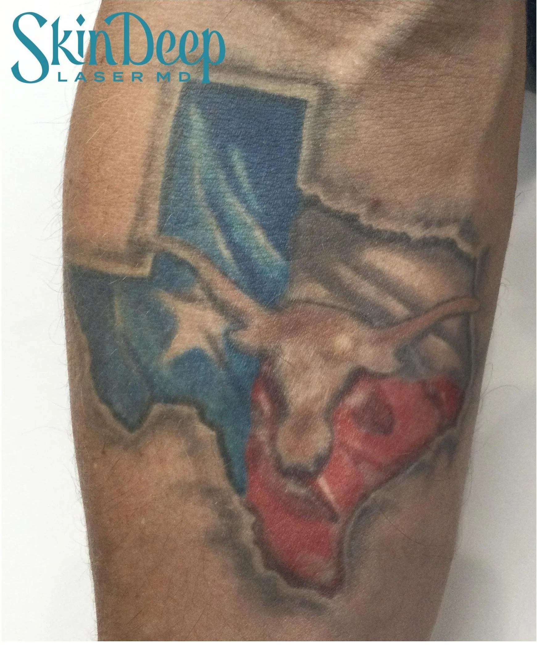 PT 064 Tattoo Before.jpg