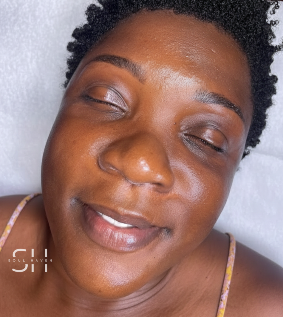 After HydroFacial Treatment
Results captured immediately following the service.