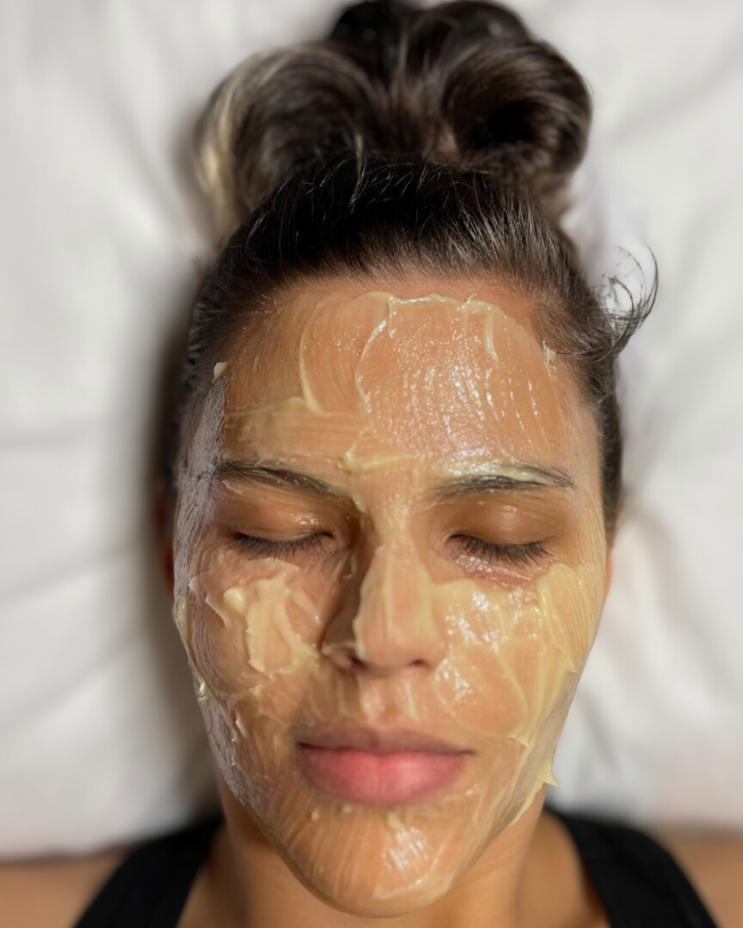  In treatment (Get Glowing Peel)