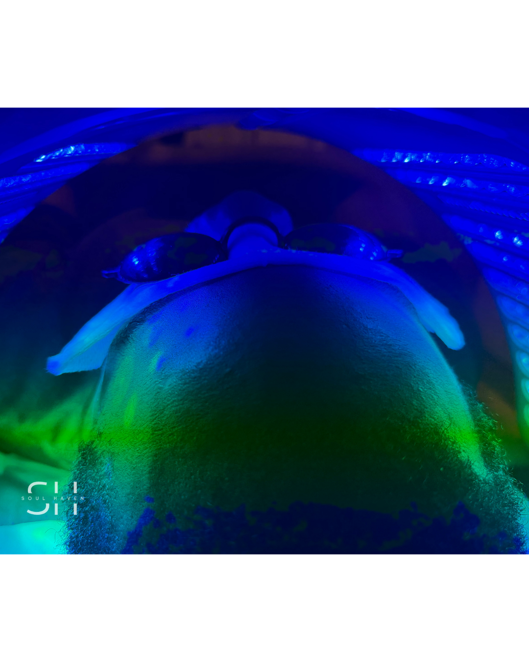 LED Facial Treatment (included in Hydrofacial)