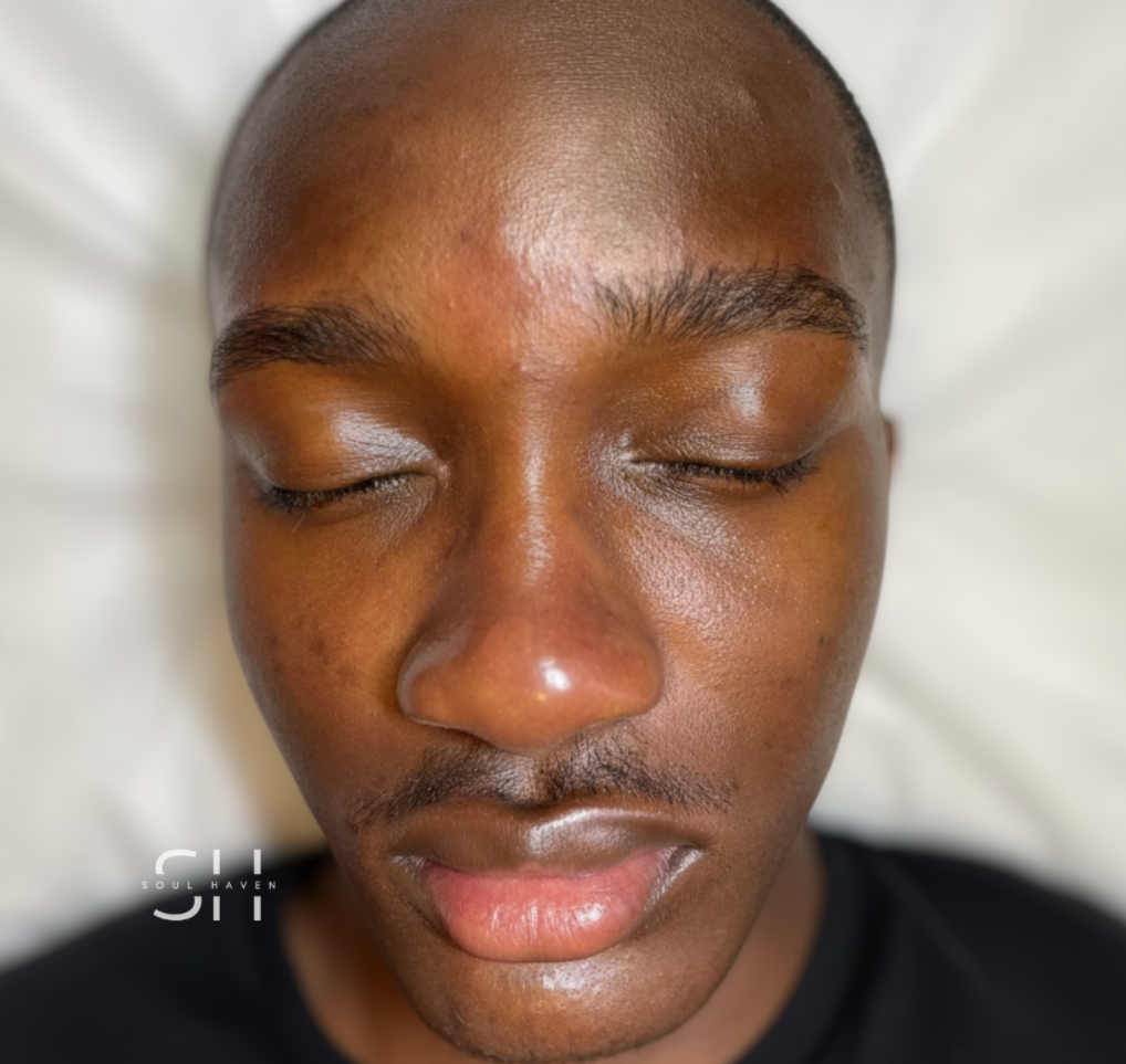 After HydroFacial Treatment
Results captured immediately following the service.