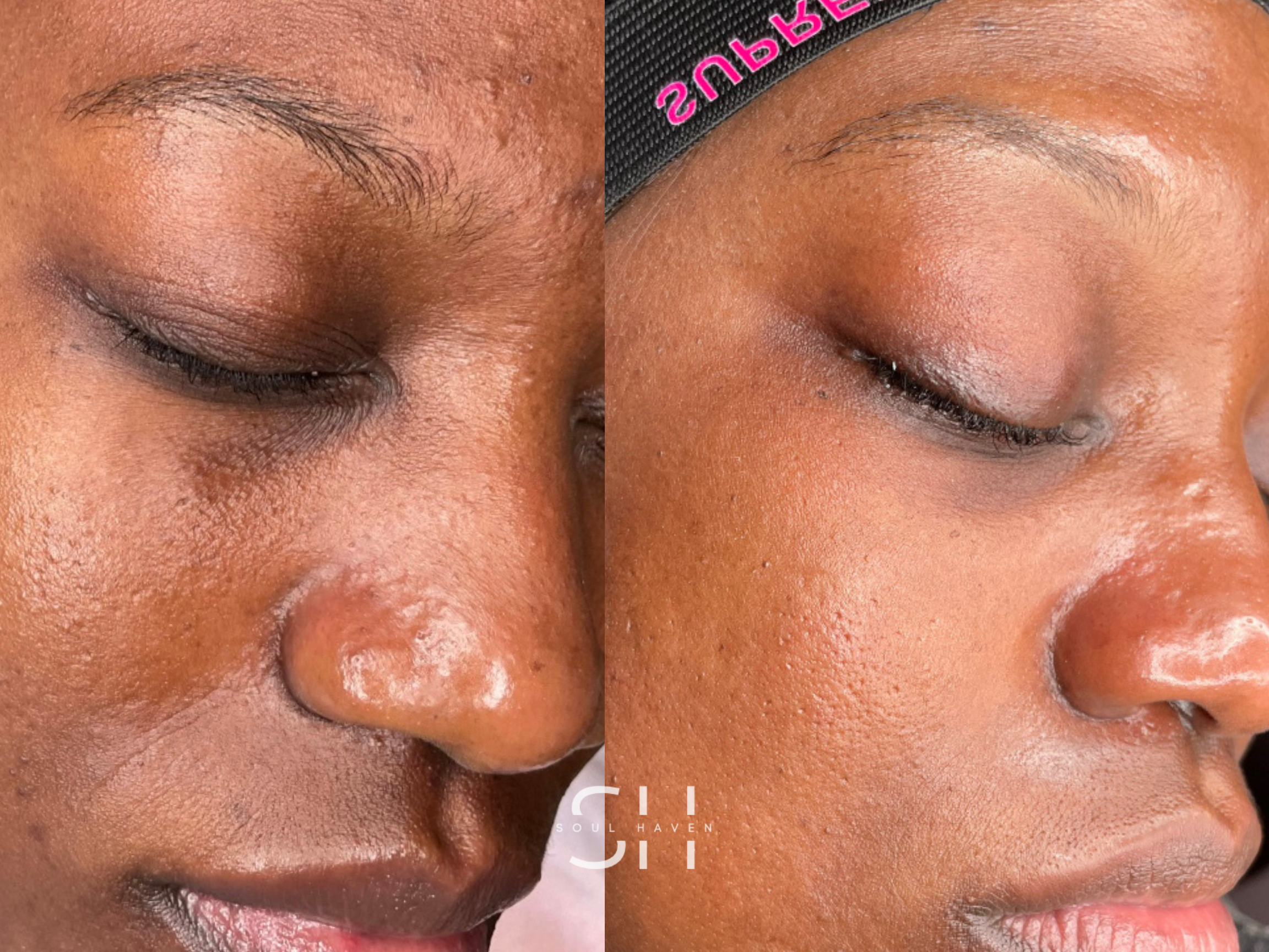 GetGlowing Peel Series
