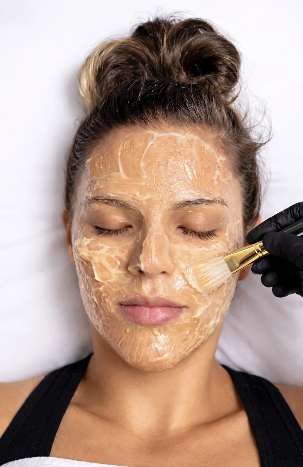 Chemical Peels