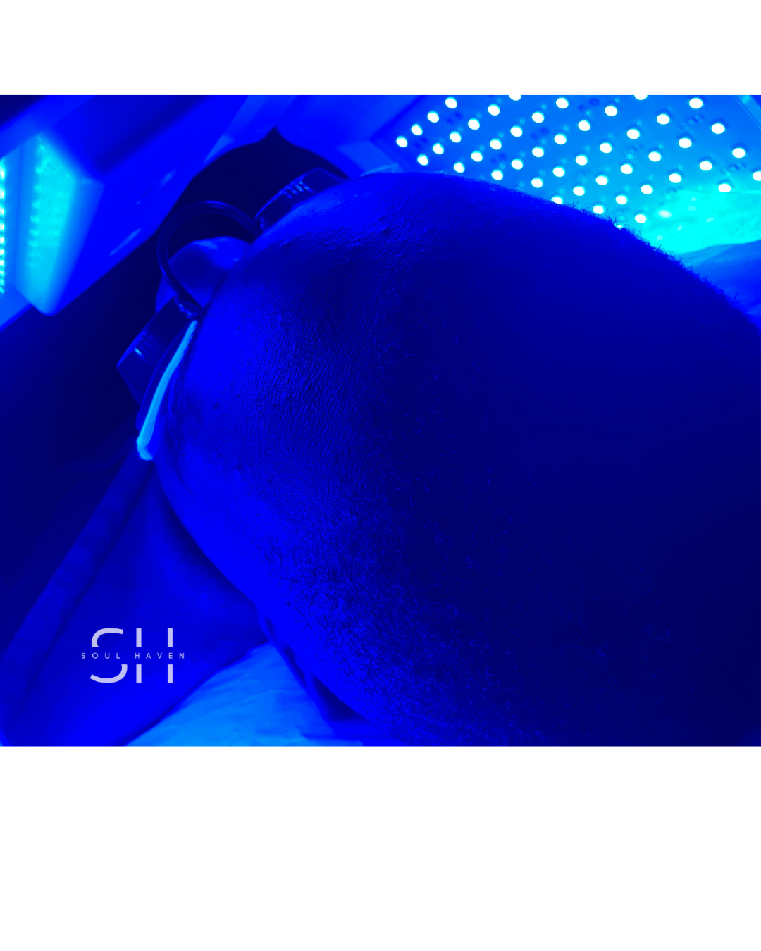 LED Facial Treatment (included in Hydrofacial)