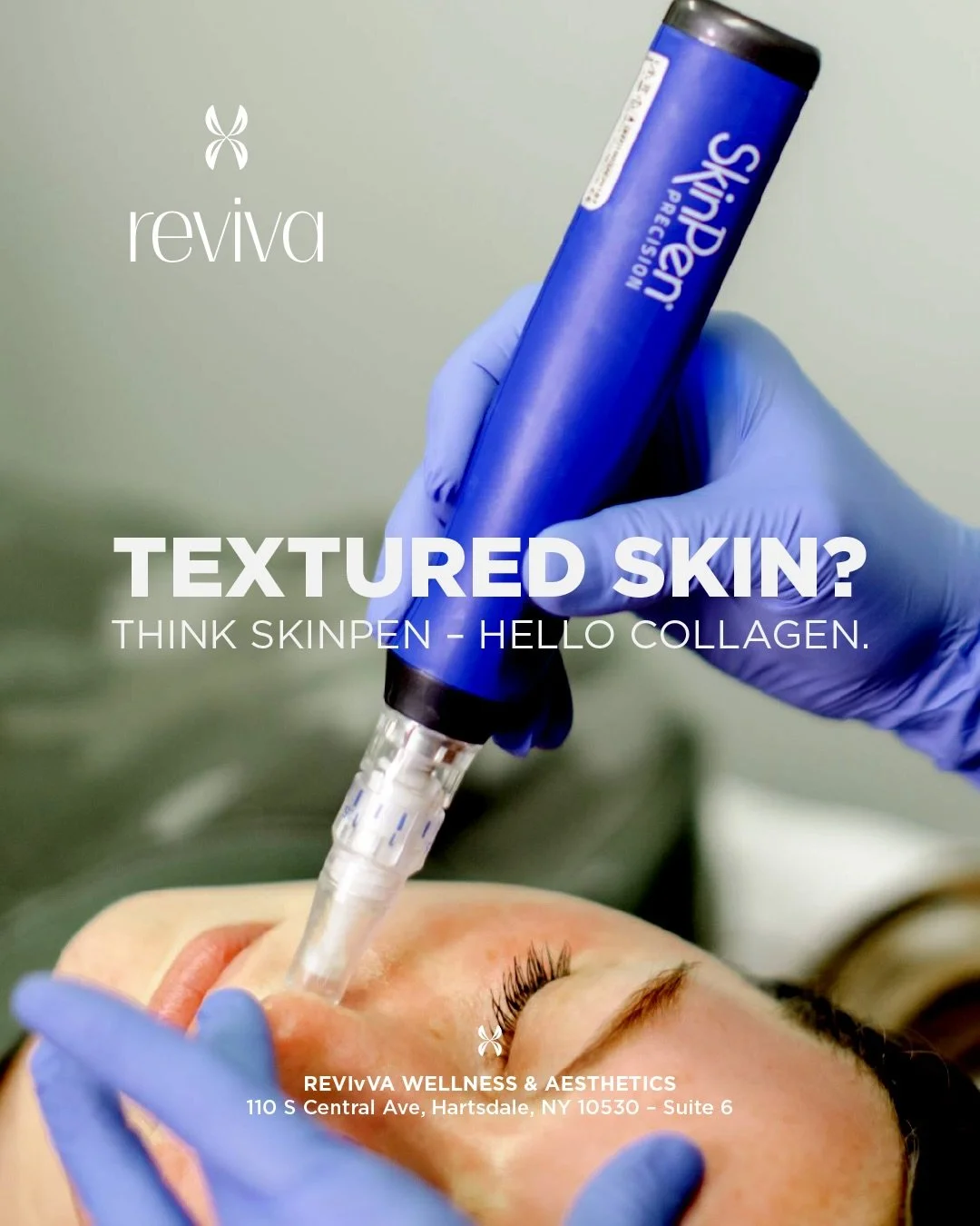 Collagen doesn&rsquo;t come in a bottle &mdash; it&rsquo;s activated ✨
SkinPen microneedling boosts collagen naturally to improve texture, scars, fine lines, and glow.

💉✨ Real skin regeneration. Real results.

💬 Comment &ldquo;COLLAGEN&rdquo; and 