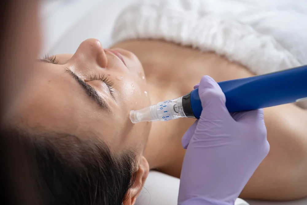 A woman receiving a facial treatment with a dermal roller or microdermabrasion device on her face in a spa or dermatologist office.