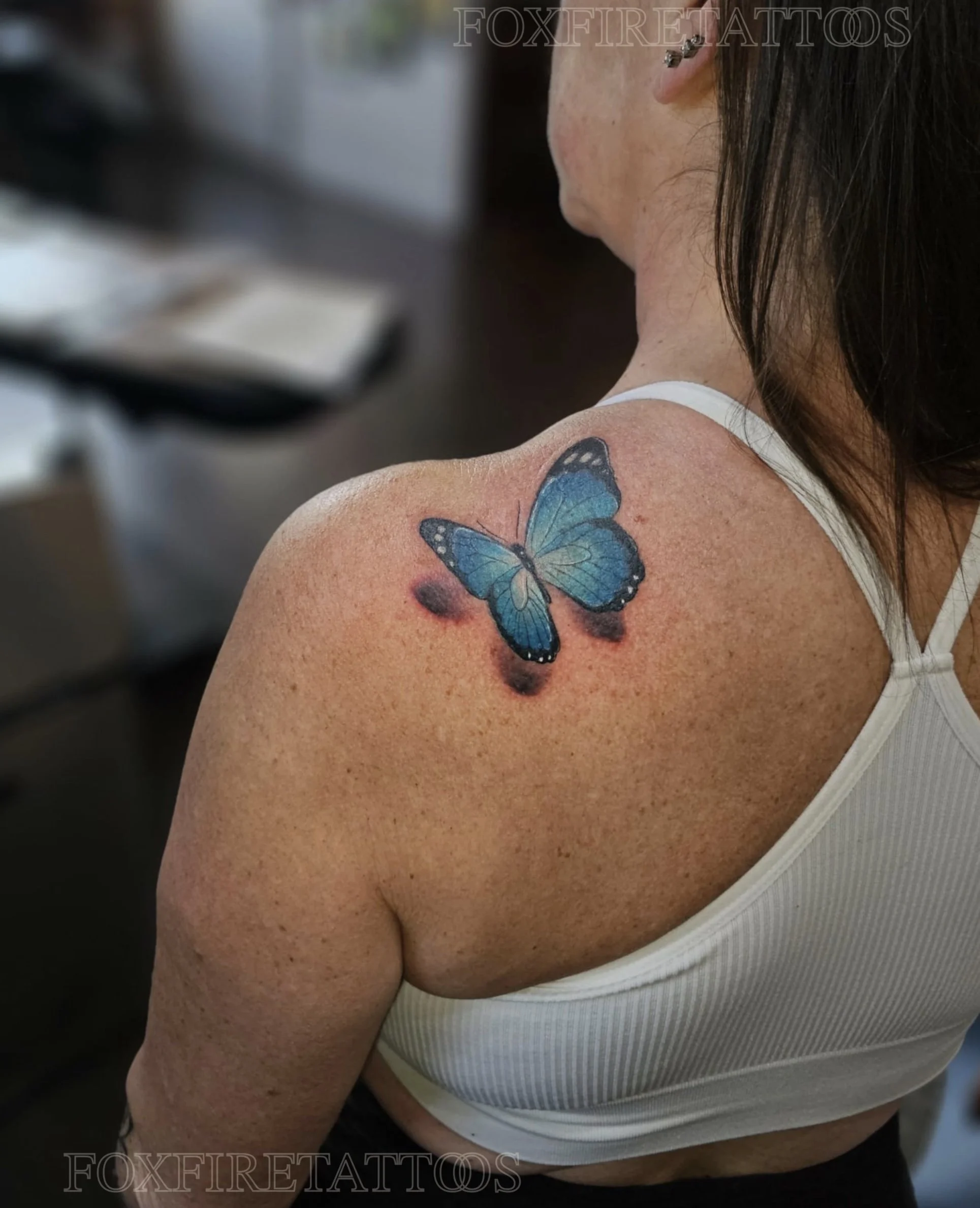 A woman with a butterfly tattoo on her shoulder, featuring blue and black colors, with a slight redness around the tattoo.