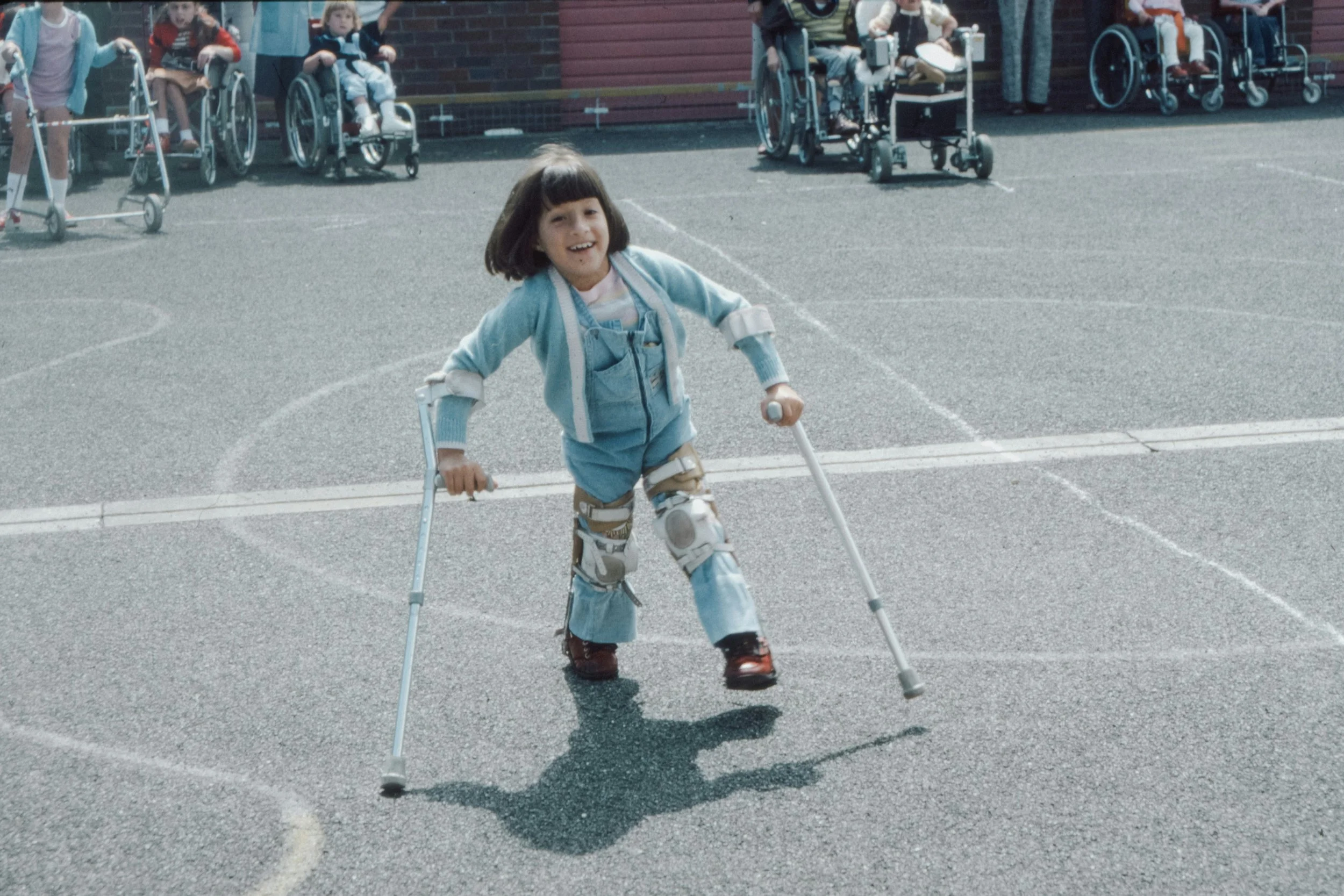 Cerebral Palsy Birth Injury
