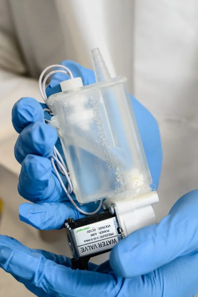 Person wearing blue gloves holding a medical pump connected to a battery, with a clear fluid container attached.