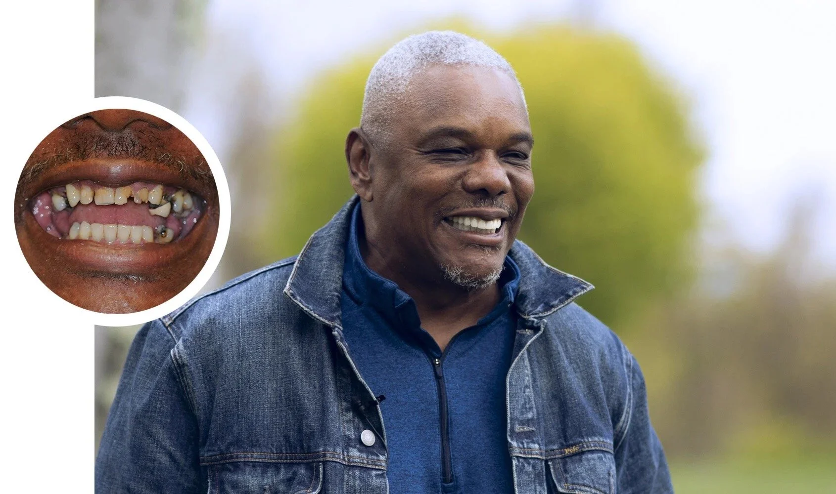 A smiling older man with short gray hair wearing a denim jacket and dark blue shirt outdoors. An inset shows a close-up of a mouth with yellowed, decayed teeth.
