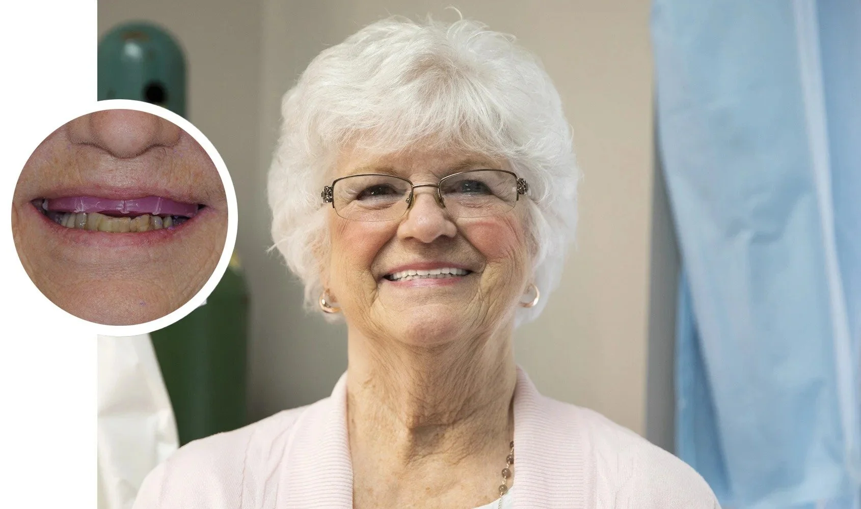 A smiling elderly woman with short white hair and glasses, close to a medical setting, with an inset showing her mouth with teeth and gums.