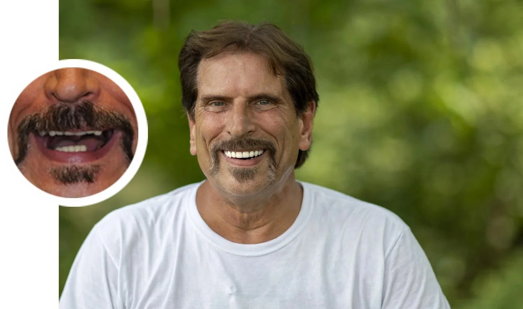 A smiling middle-aged man outdoors with a blurred green background, wearing a white t-shirt. An inset shows a close-up of the man's mouth, revealing missing teeth and a mustache.