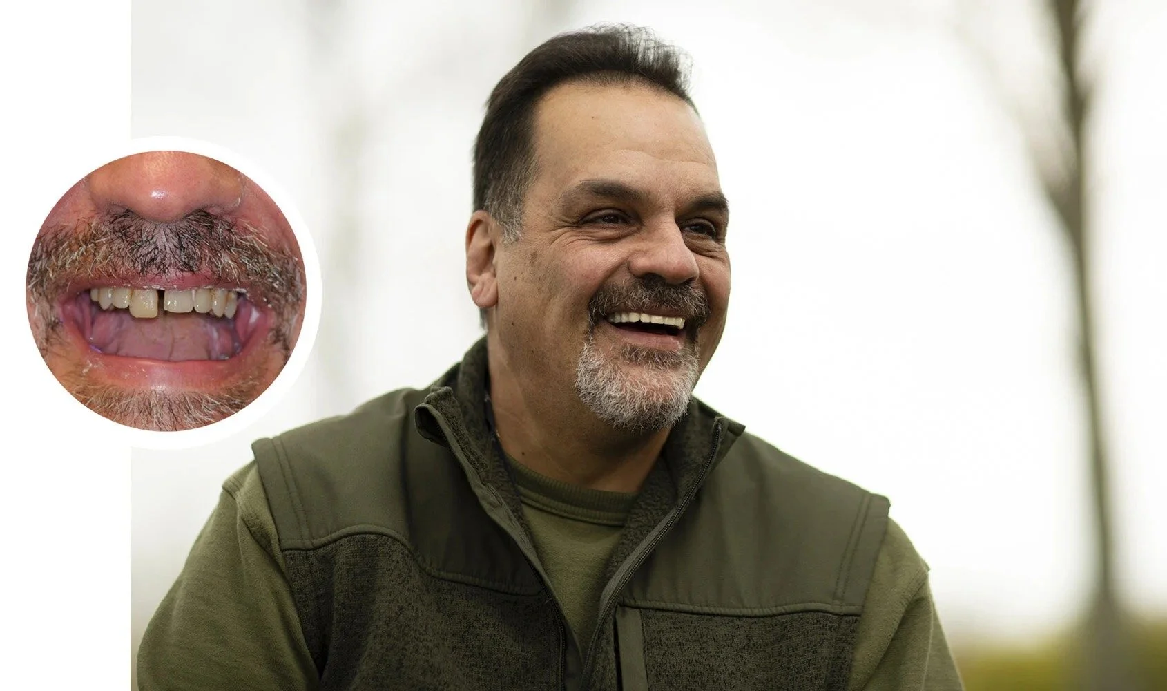 A man is smiling brightly outdoors, wearing a green jacket. An inset zooms in on his mouth, showing missing teeth and dental issues.