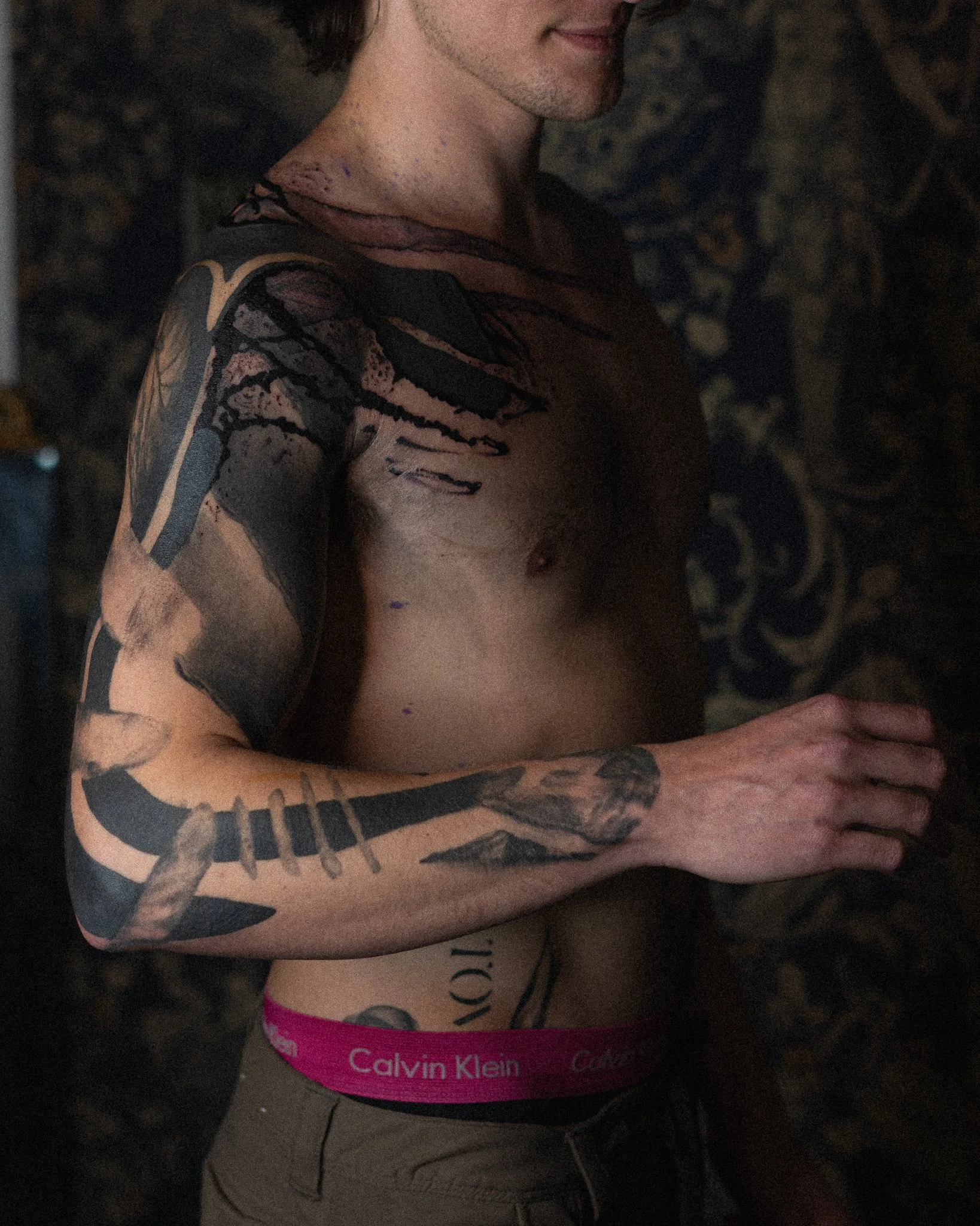 Nathan: Healed forearm, fresh blastover on shoulder