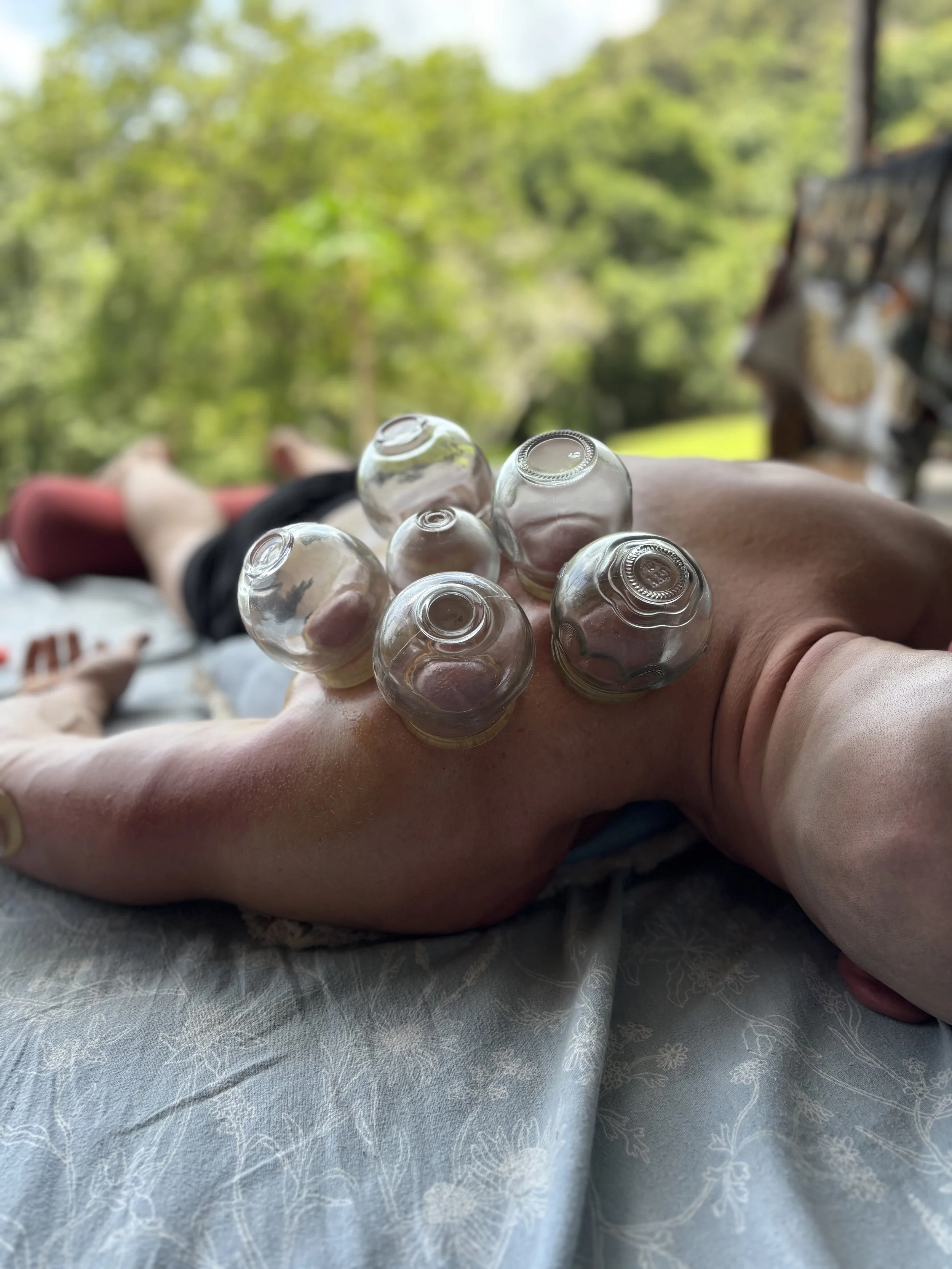 Fire Cupping & Moxibustion