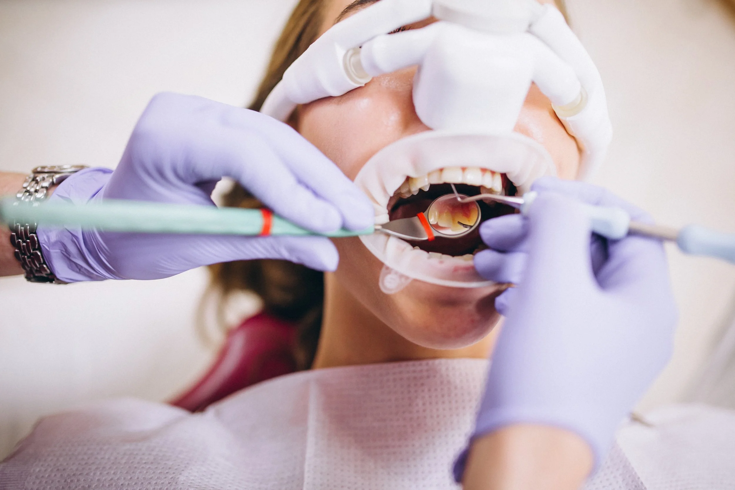 Dentist wearing gloves performs a dental surgery on a patient lying back in a dental chair with a mouth retractor.