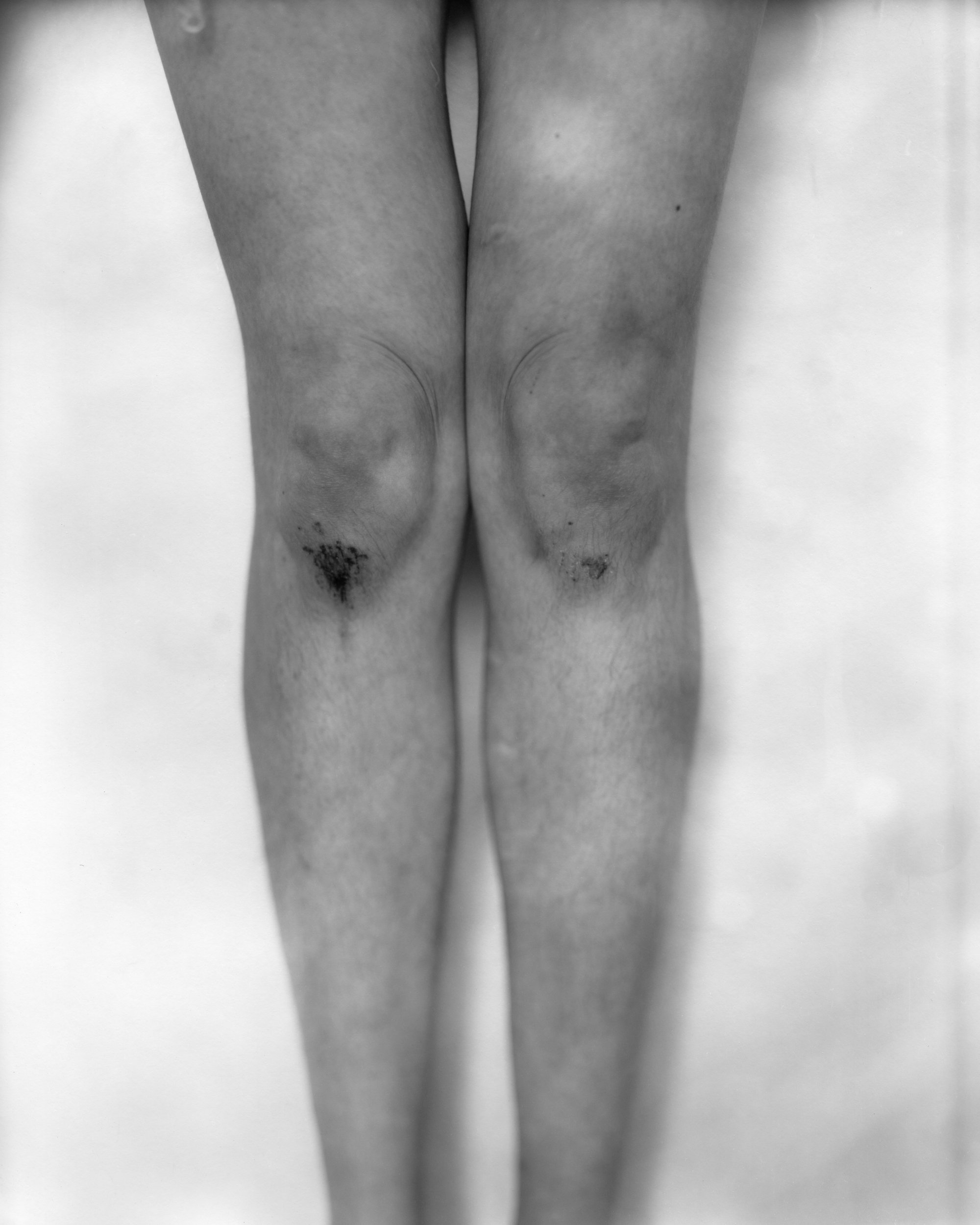 heather brown_skinned knees_image 1 - Heather Brown.jpg