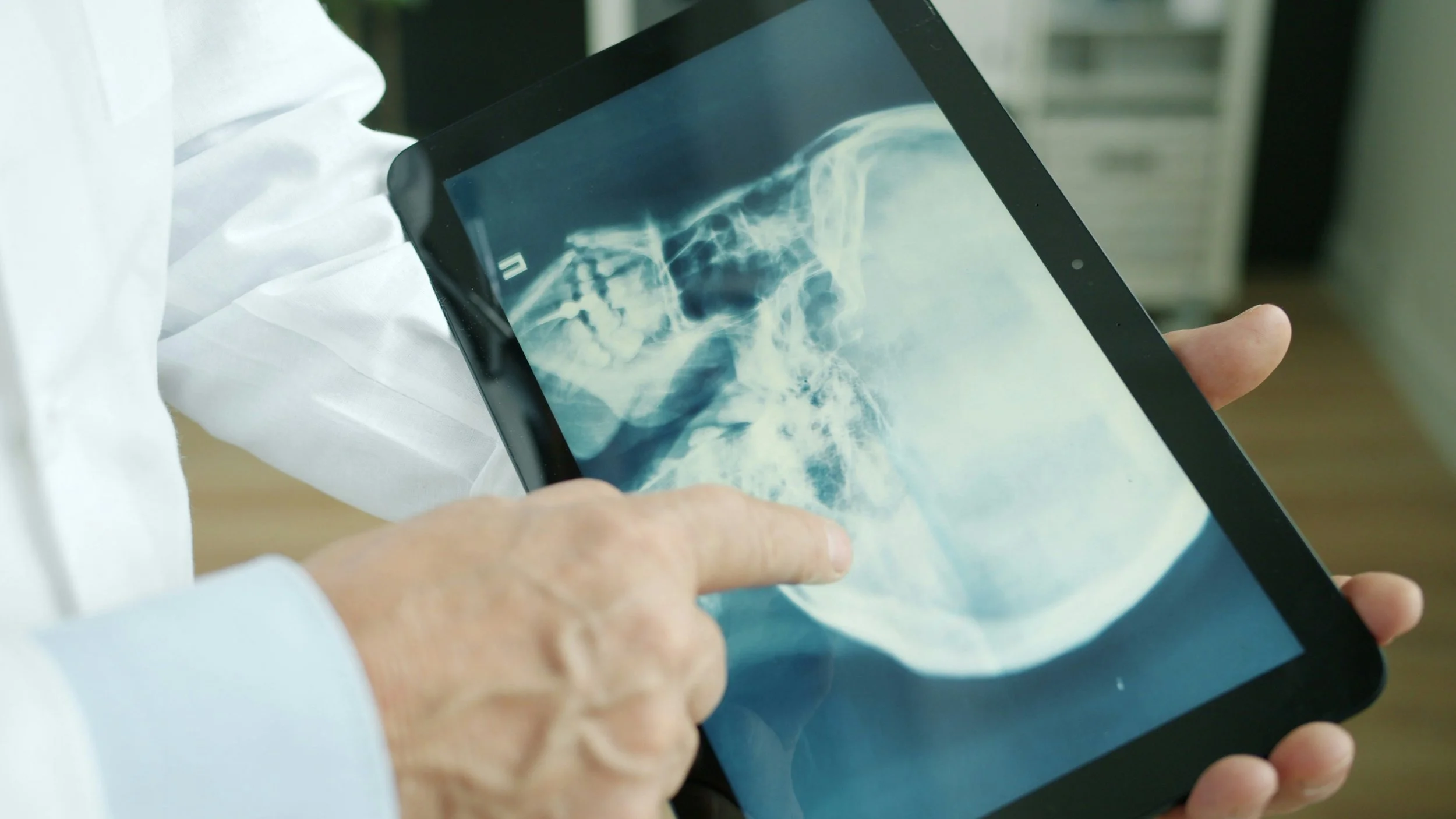 Un médecin âgé montrant une radiographie du crâne sur une tablette numérique.