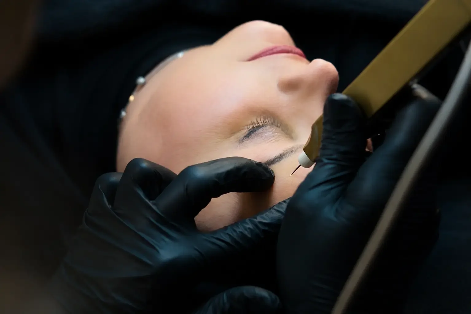 Plasma-Pen-Behandlung zur nichtinvasiven Lidstraffung und Hautverjüngung im Cosmetics-Bereich bei Garzareck in Halle (Saale).