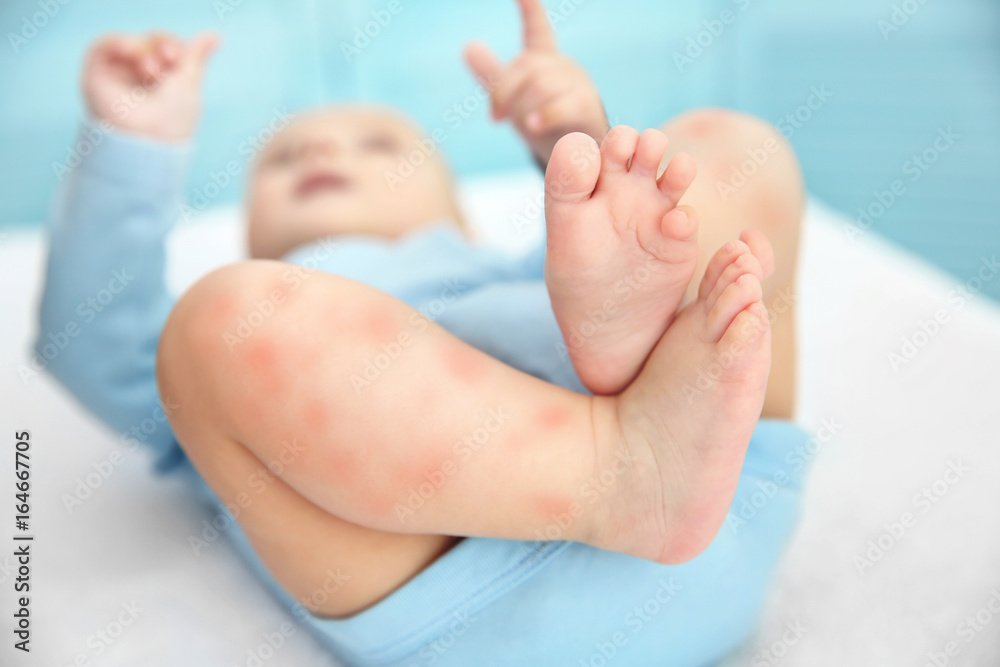 The Unhealth Generation: Understanding the Root of Rising Childhood Diseases