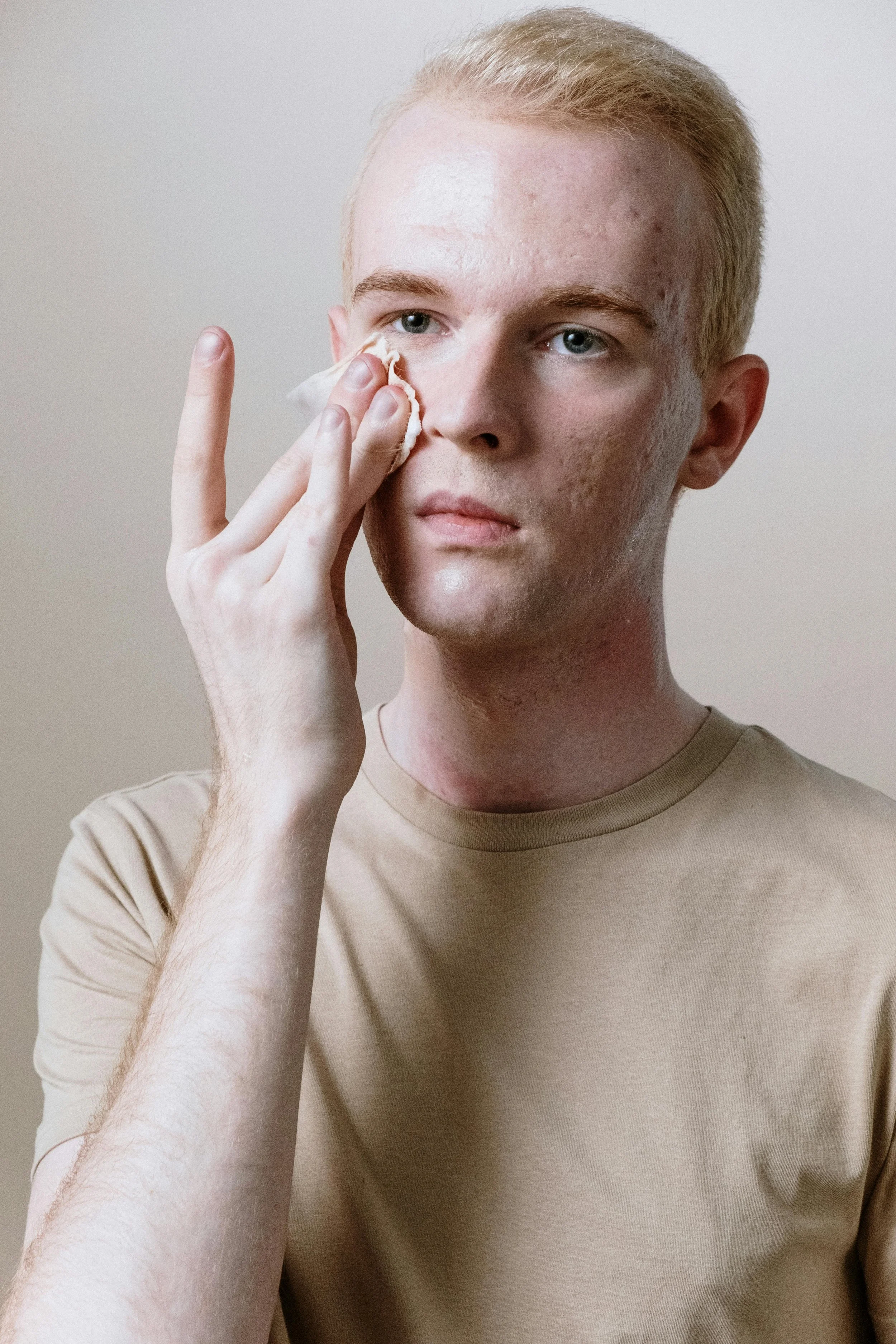 Young man with blonde hair and light skin is cleaning his face with a cotton pad or towel.
