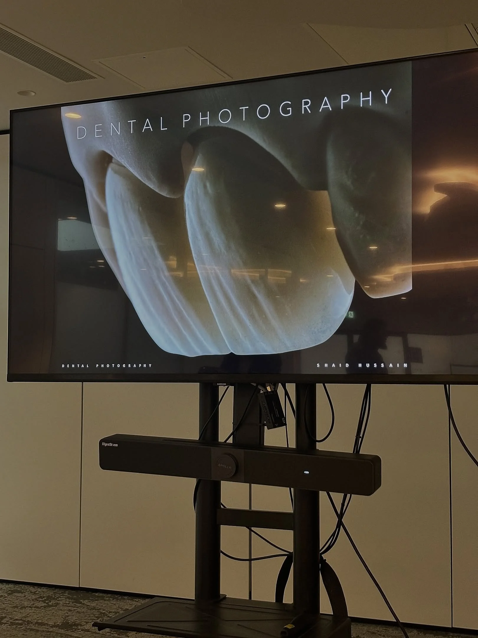 Unbelievable experience with @drshaidhussainbds @dental_explorer . Nothing but accuracy and precision throughout 📈. 

Highly recommend everyone to check him out ! 

Thank you and forever grateful for the opportunity brother 🙏. 

#photograph #dental