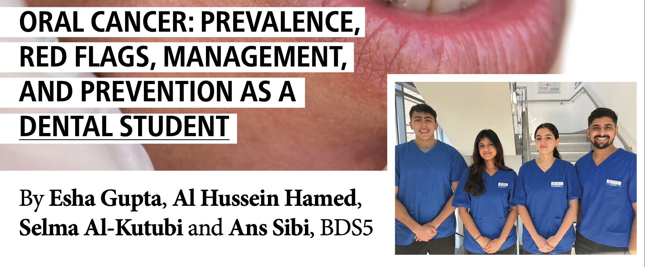 Close-up of a person's lips with red flags indicating signs of oral cancer, alongside a group of four diverse dental students wearing blue scrubs in a well-lit institutional setting.