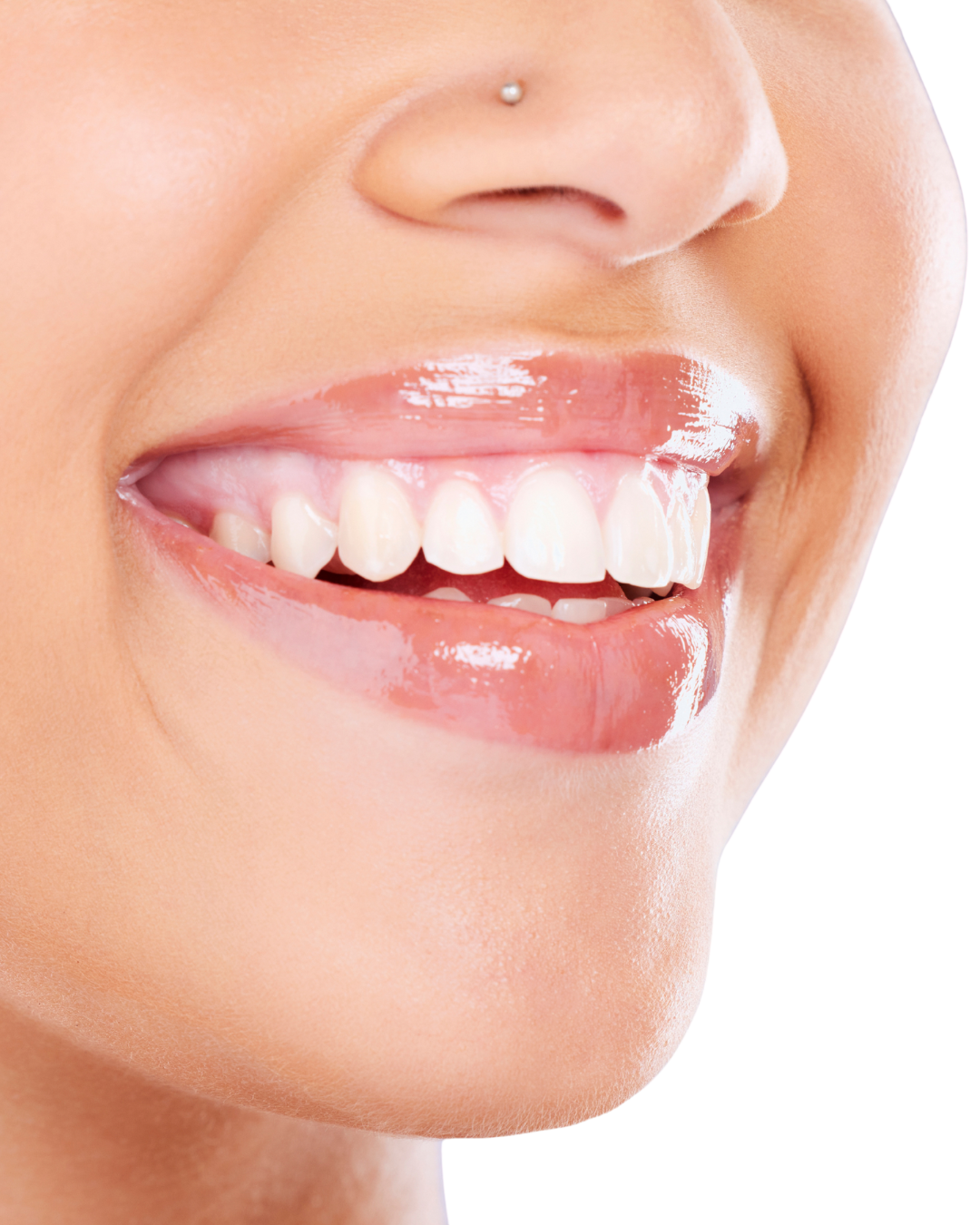 Close-up of a person smiling with visible teeth, pink lips, and a small nose piercing.