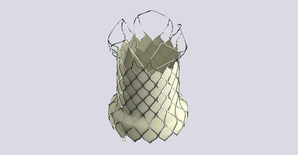 Valvula Pulmonar VenusP de Venus Medtech