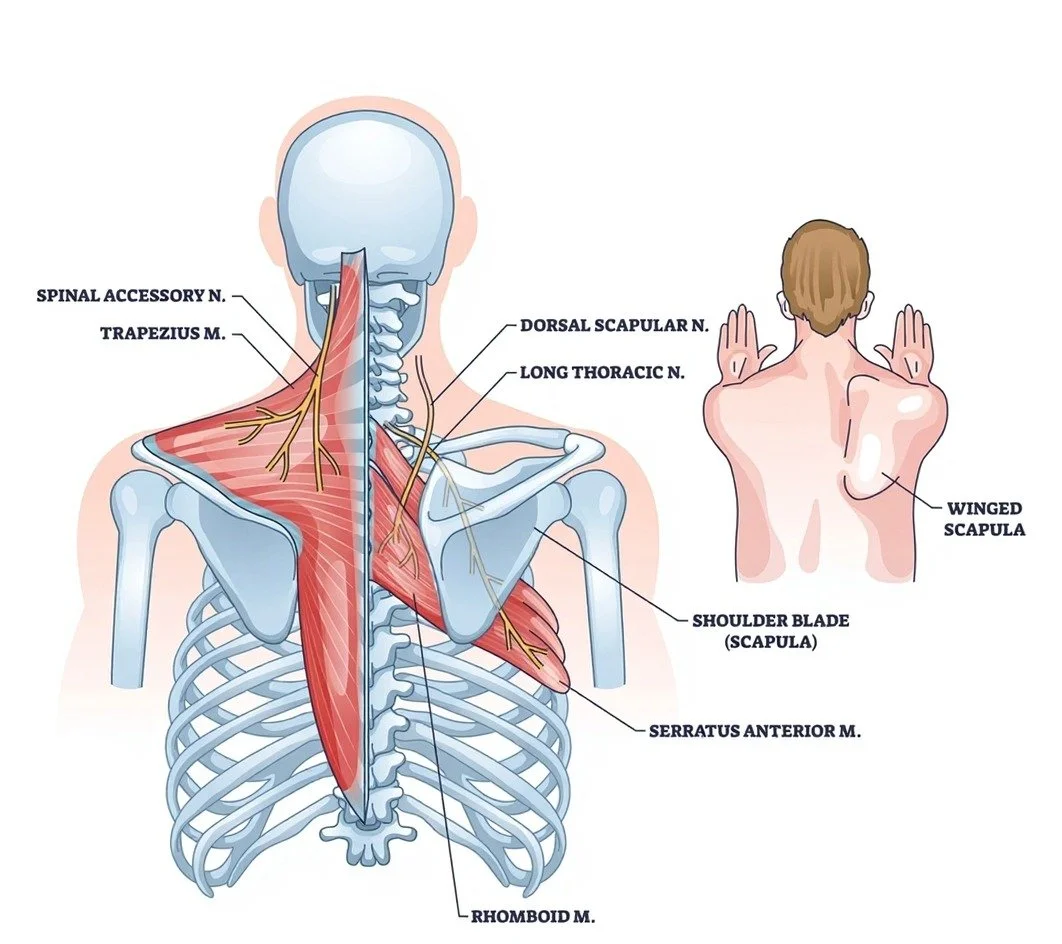 Diagram of the upper back and shoulder muscles showing the trapezius, shoulder blade, and other muscles, with a person illustrating a winged scapula. - Dr. Kevin Wall, Richmond, VA