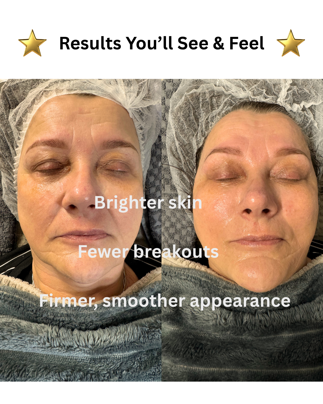 Ultimate Radiance Lift Facial Treatment