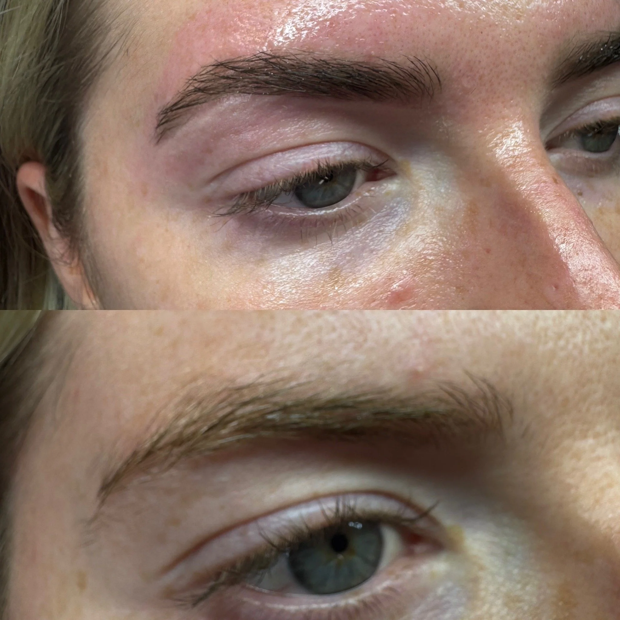 Close-up of a person's eyes and eyebrows, showing the upper part of the face with visible skin and eye details.