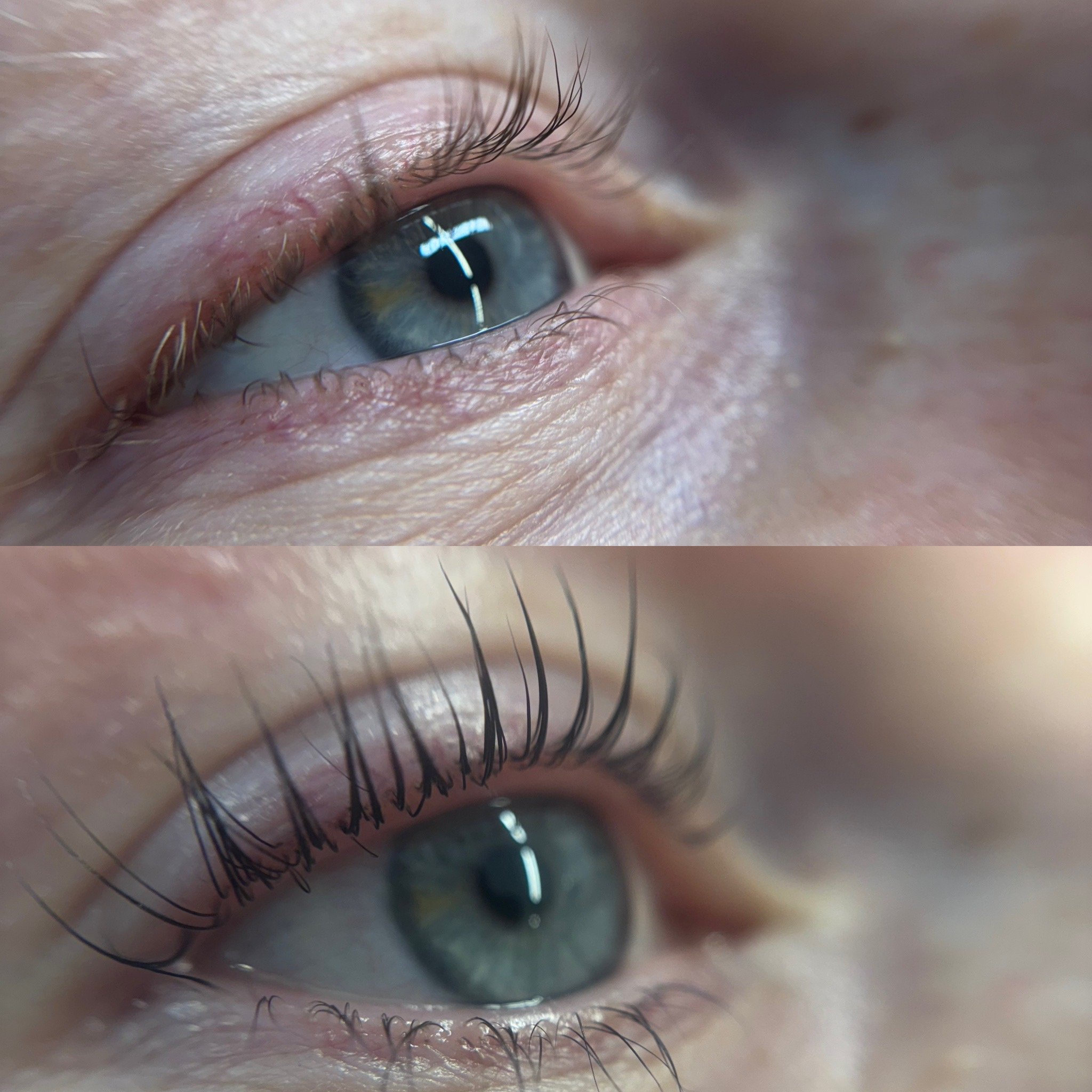 A close-up of a human eye showing the upper and lower eyelid, eyelashes, and details of the iris and pupil.