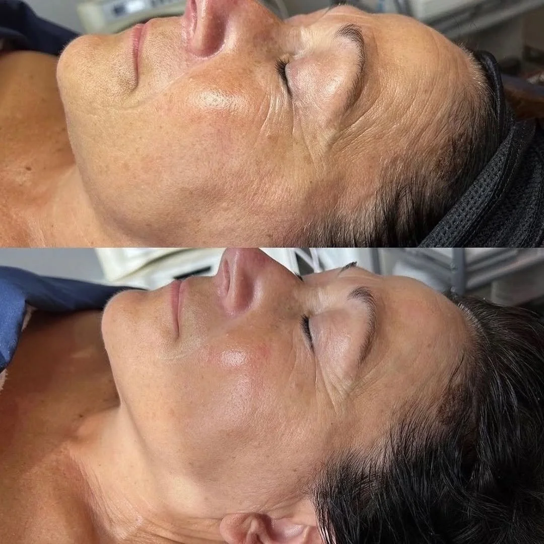 Firming Enzyme skinbypresley.jpg