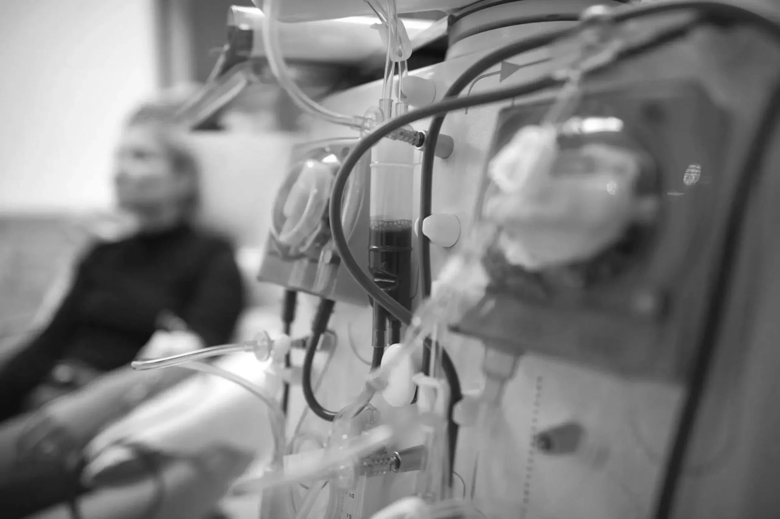 Hemodialysis